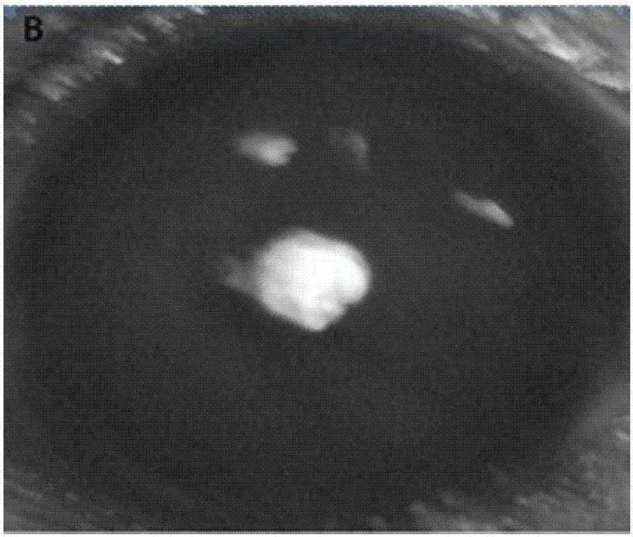 Application of adiponectin or mixed liquid of adiponectin and insulin in improving and treating ocular surface corneal epithelium and nerve injury