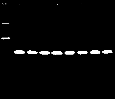 PCR (polymerase chain reaction) detection primers for three bacteria and application thereof