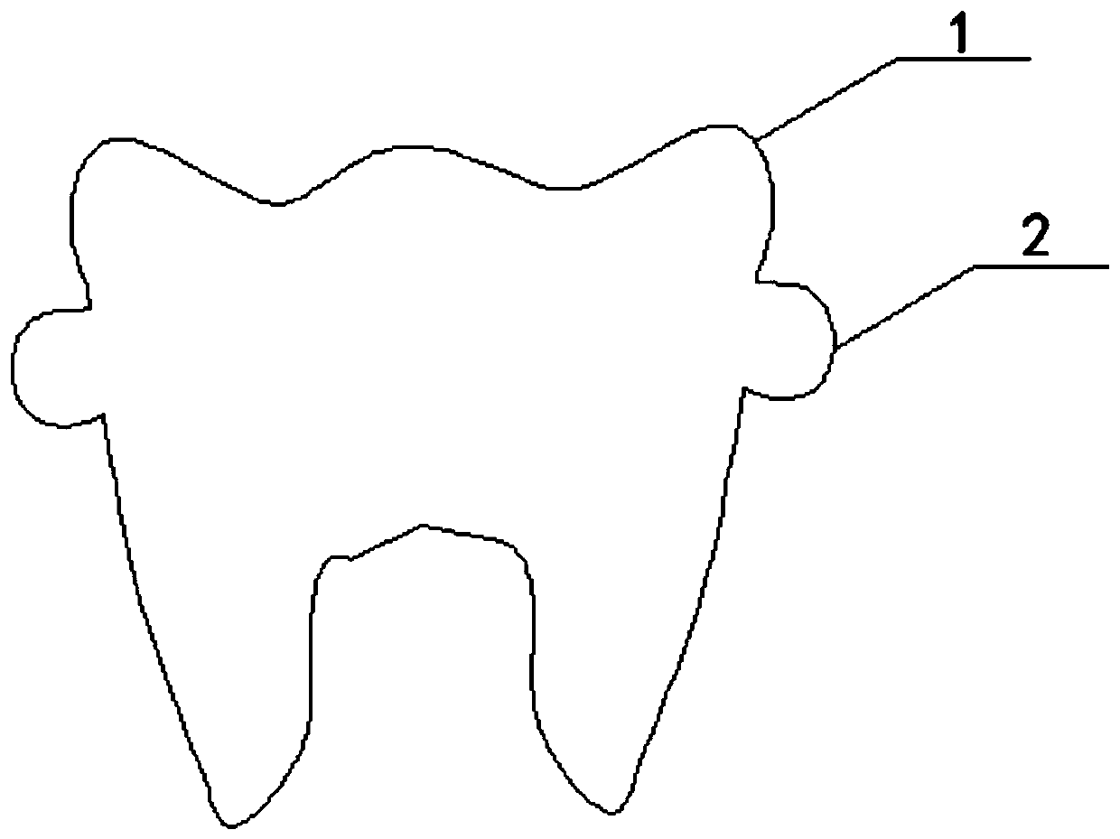 Mounting method of resin try-on crown and all-ceramic preformed crown thereof