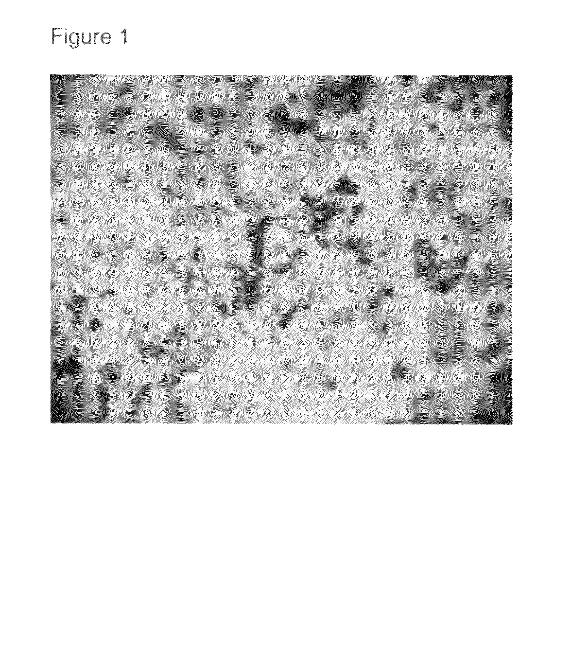 Crystal of human interferon alpha 2B in complex with zinc