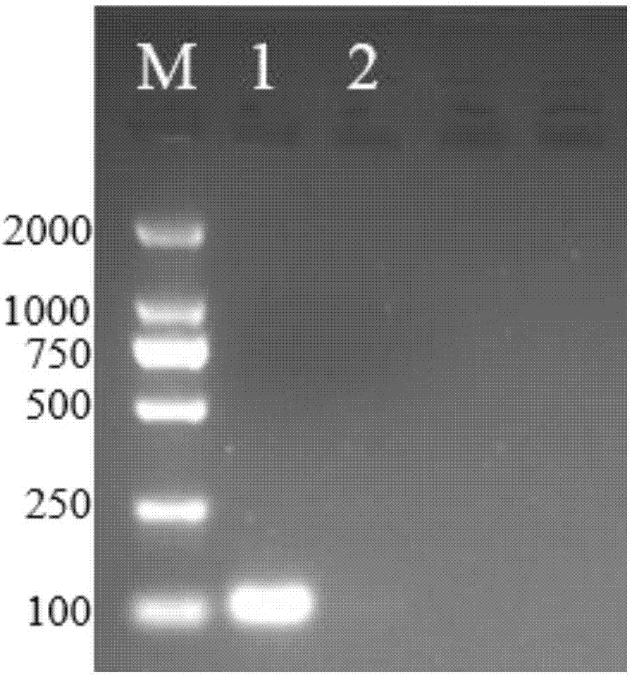 Absolute fluorescence quantitative PCR (Polymerase Chain Reaction) primer and kit for detecting atypical porcine pestivirus