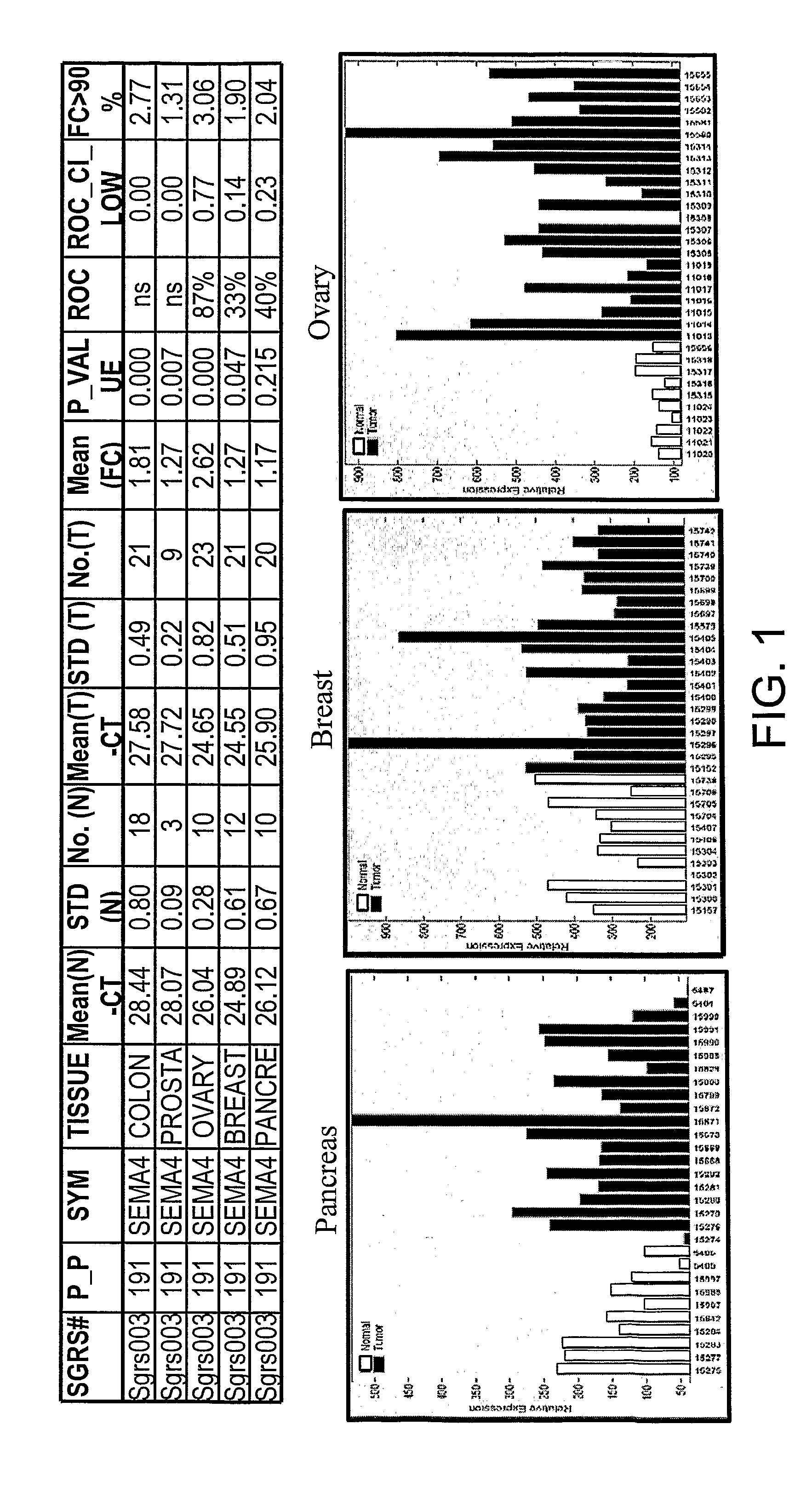 SEMA4D in Cancer Diagnosis, Detection and Treatment