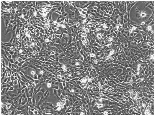 Recombinant cell strain HSCT6-rADHI as well as construction method and application thereof