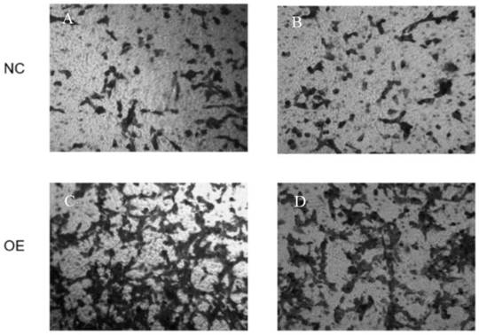 Recombinant cell strain HSCT6-rADHI as well as construction method and application thereof