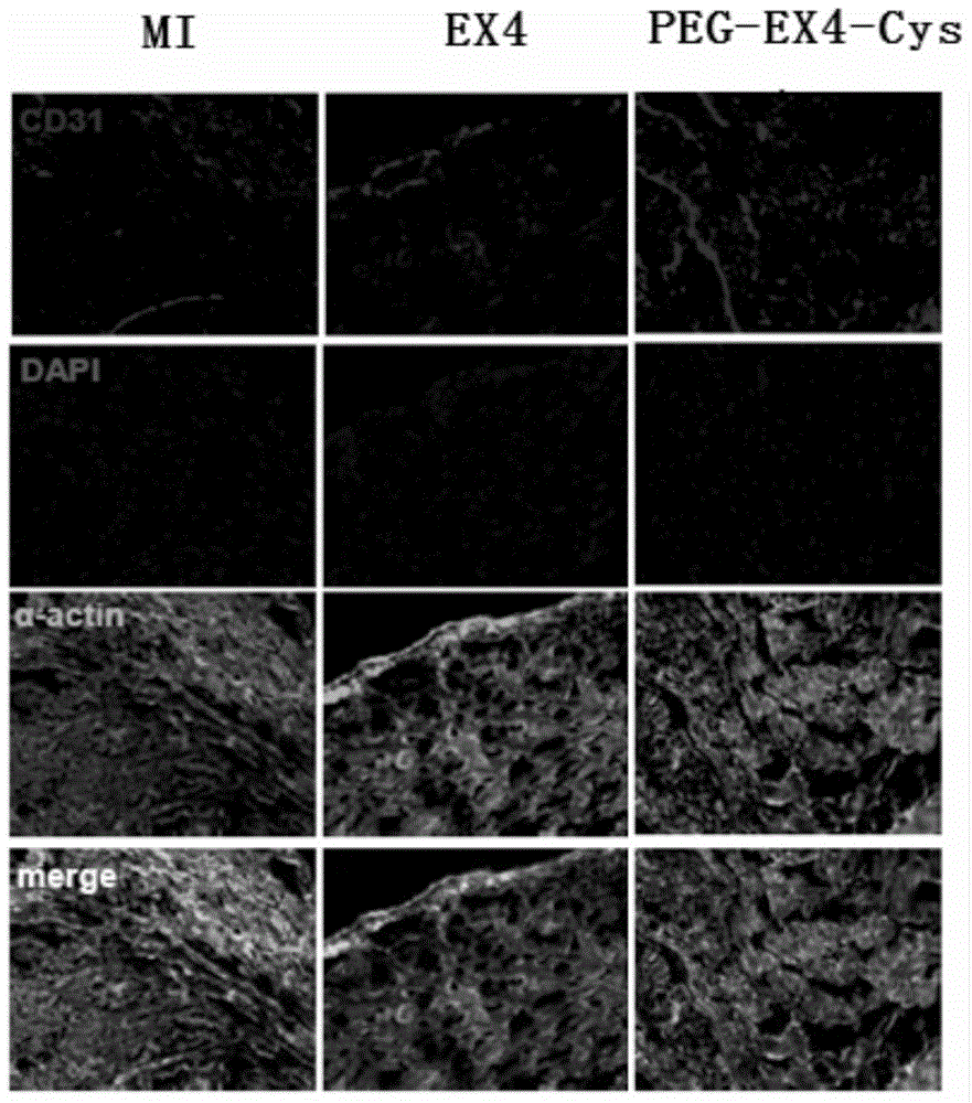 Polyethylene glycol-modified exendin analog, and preparation method and application thereof