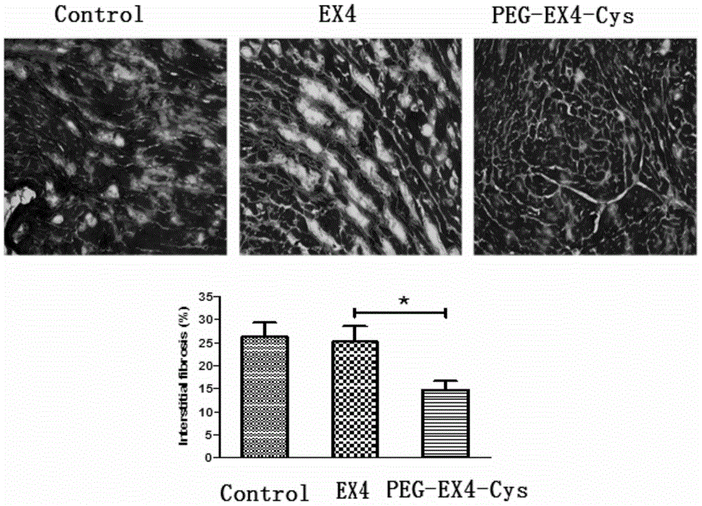 Polyethylene glycol-modified exendin analog, and preparation method and application thereof