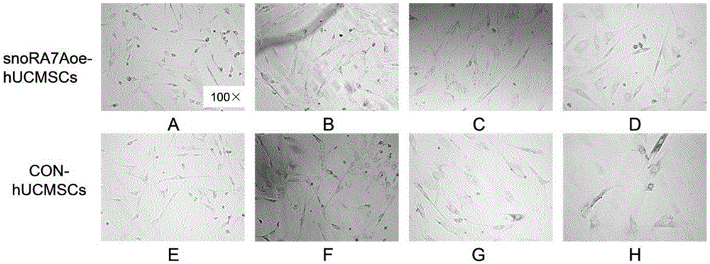 Method for enhancing proliferative capacity of hUCMSCs and application of method