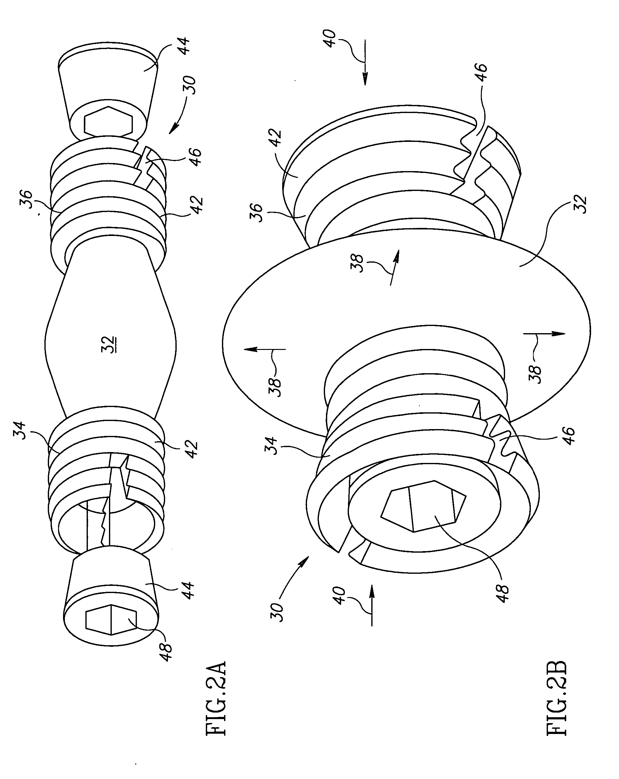 Facet prosthesis