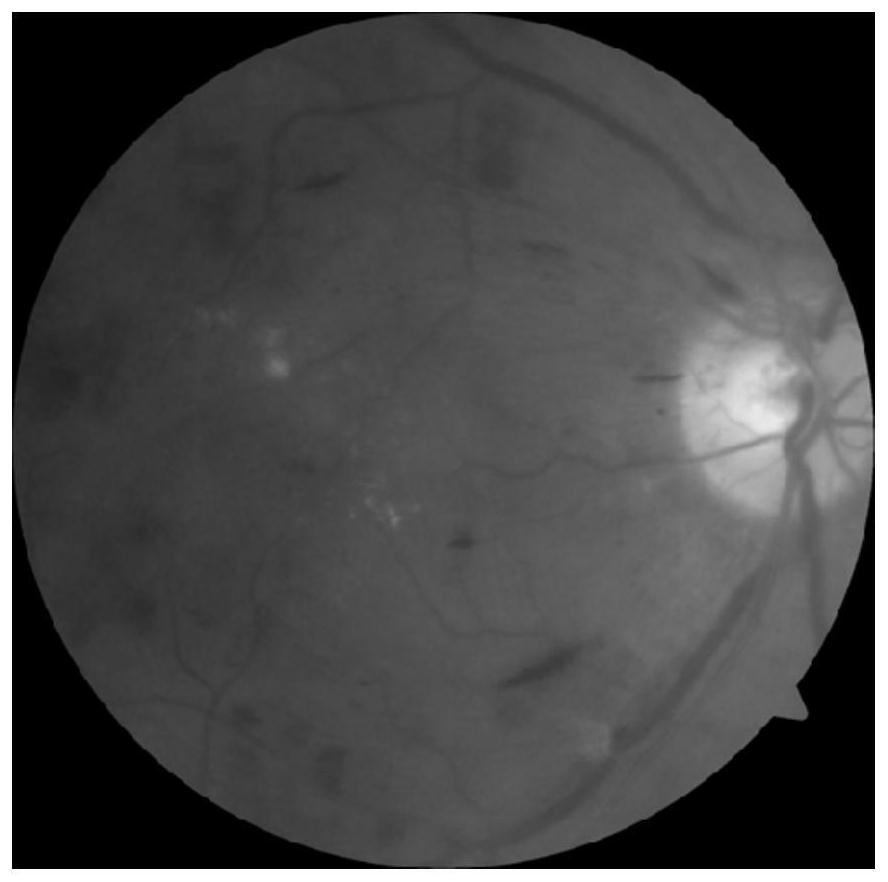 Training method and training system for tissue lesion recognition based on artificial neural network