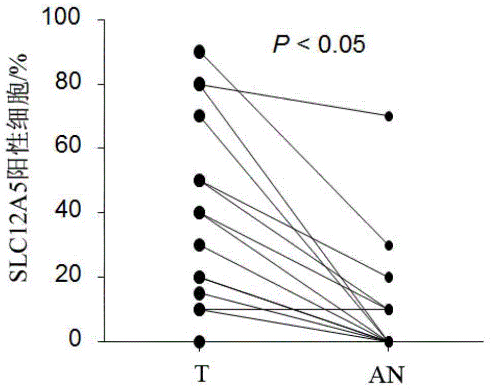 Colorectal cancer prognosis marker, expression evaluation method, kit and applications