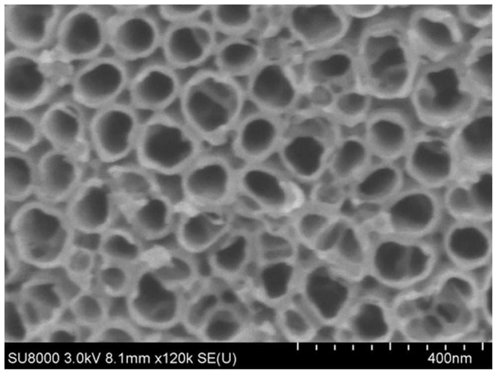 Electrochemiluminescence biosensor for detecting ulinastatin