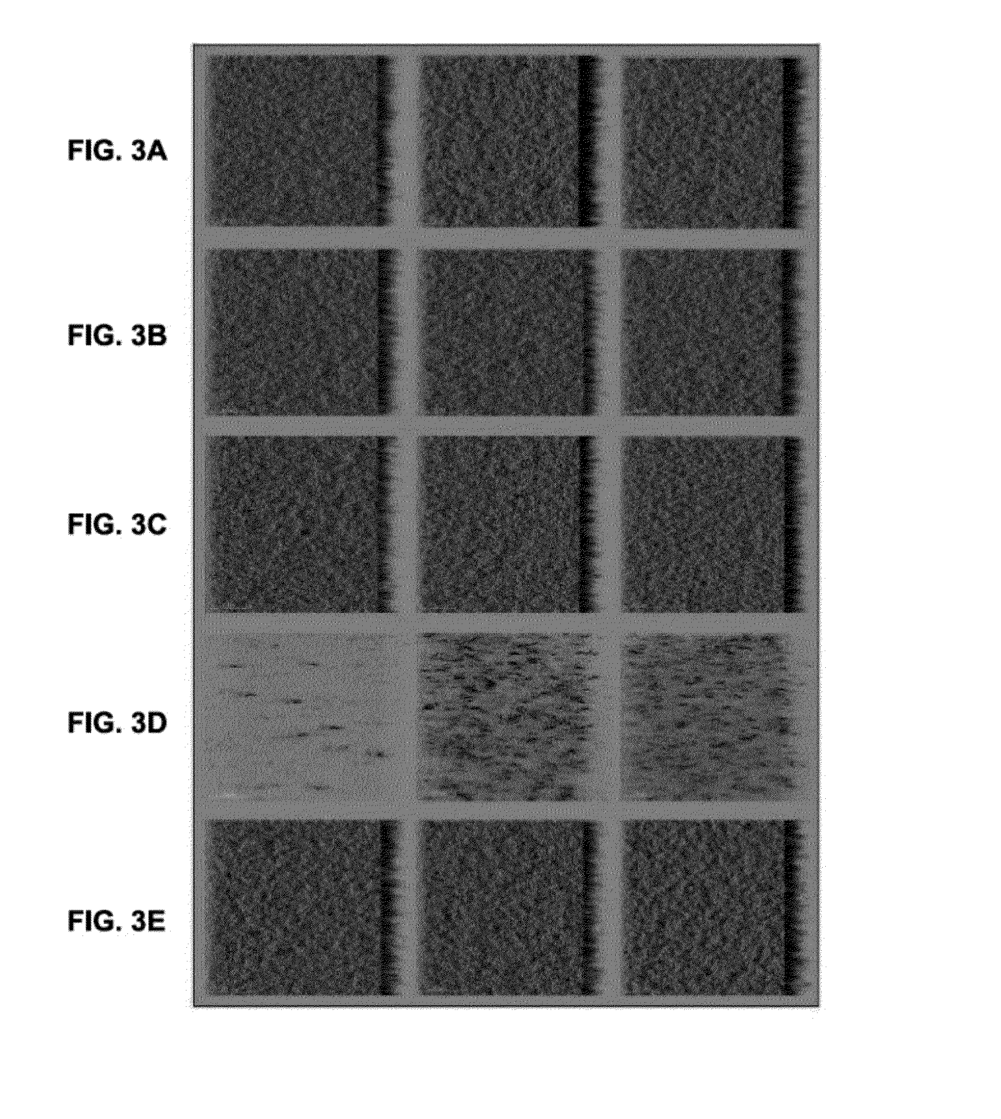 Method for Removing a Microorganism Biofilm