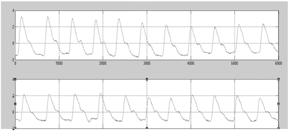 Coated tongue image monitoring equipment