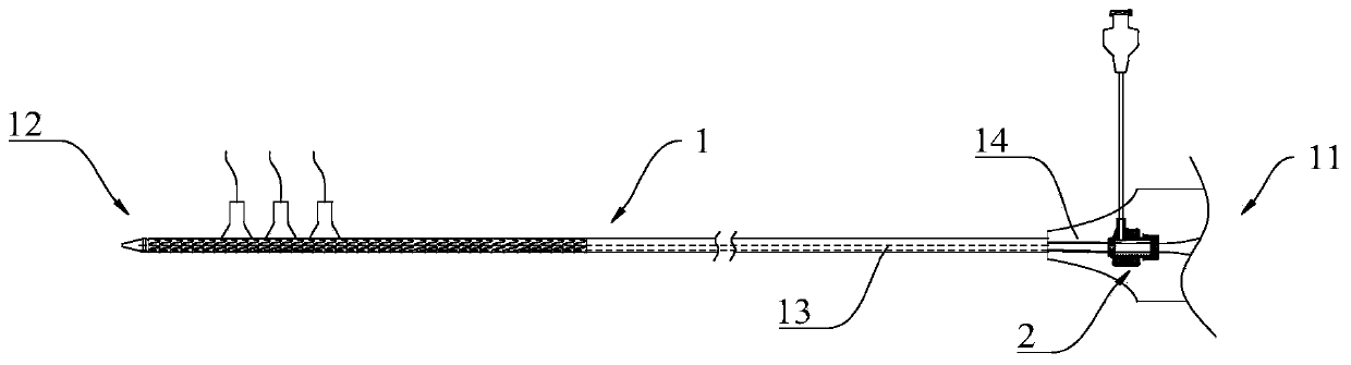 Stent implantation conveyor and implantation system