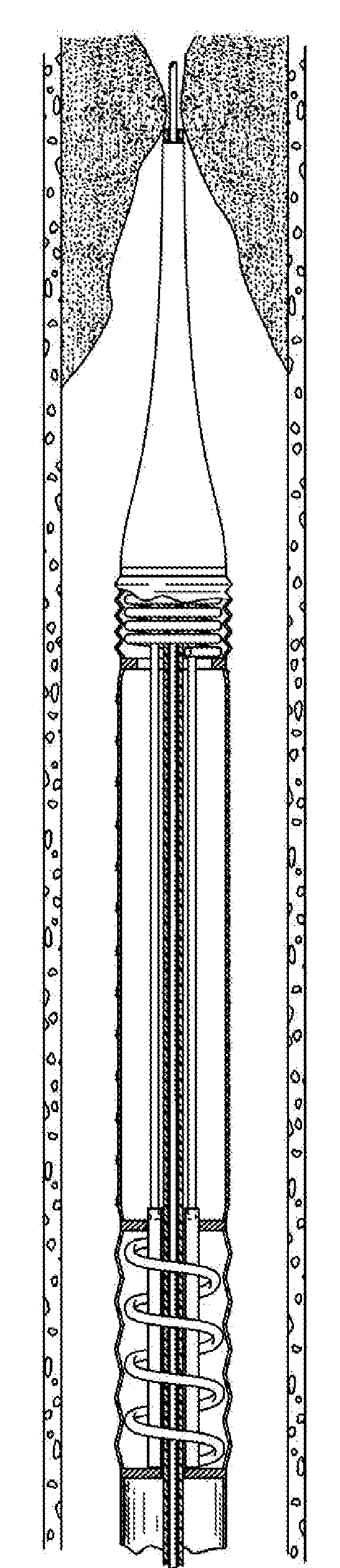 Mechanical propulsion catheter apparatus and methods