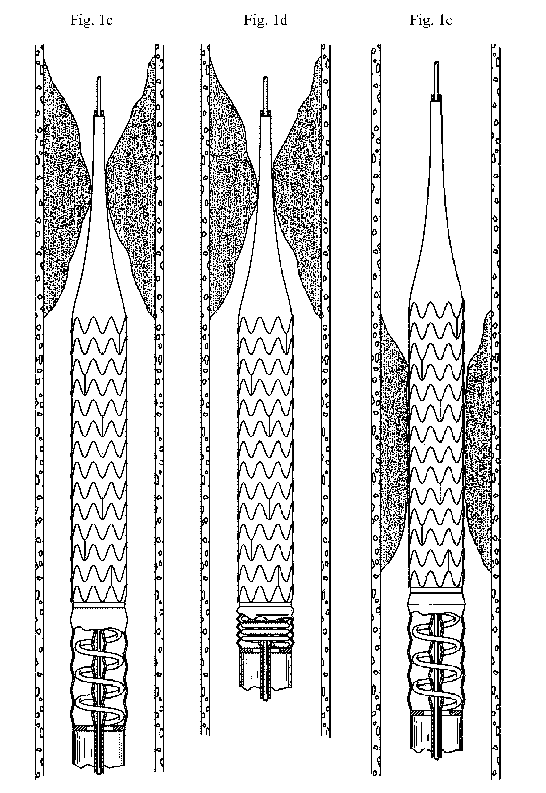 Mechanical propulsion catheter apparatus and methods