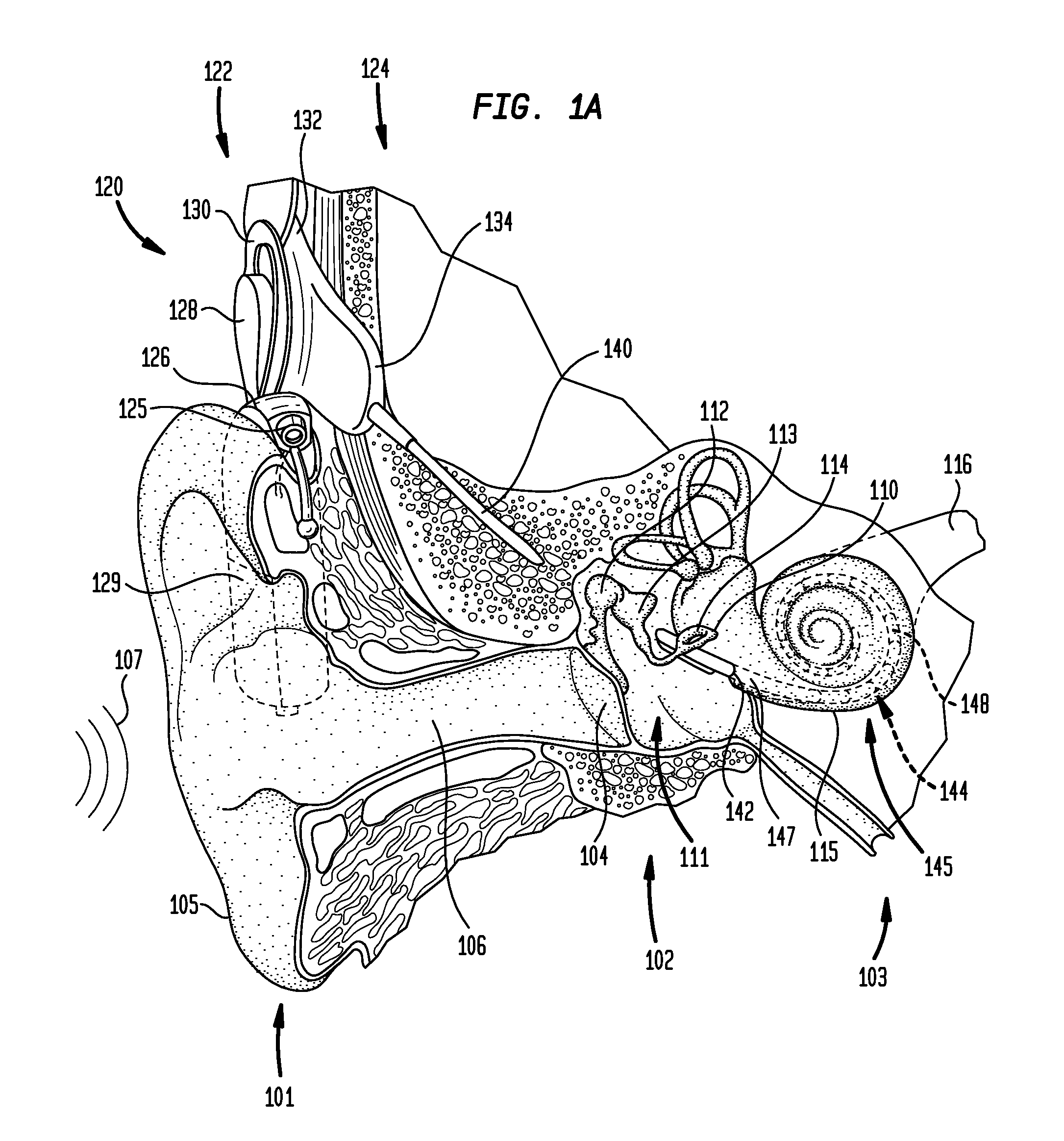 Drug-delivery element for an elongate implantable medical device component