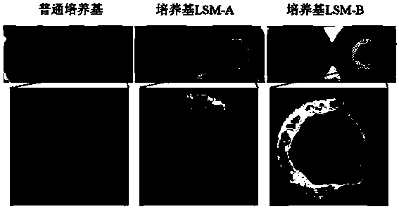 Culture medium for hepatoma organoid cell sphere culture