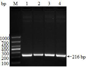 Genetic engineering strain for displaying Escherichia coli enterotoxin by Saccharomycetes and application of genetic engineering strain