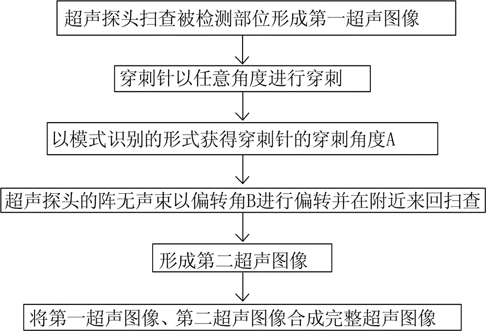 Full-automatic puncture needle developing enhancing method based on pattern recognition