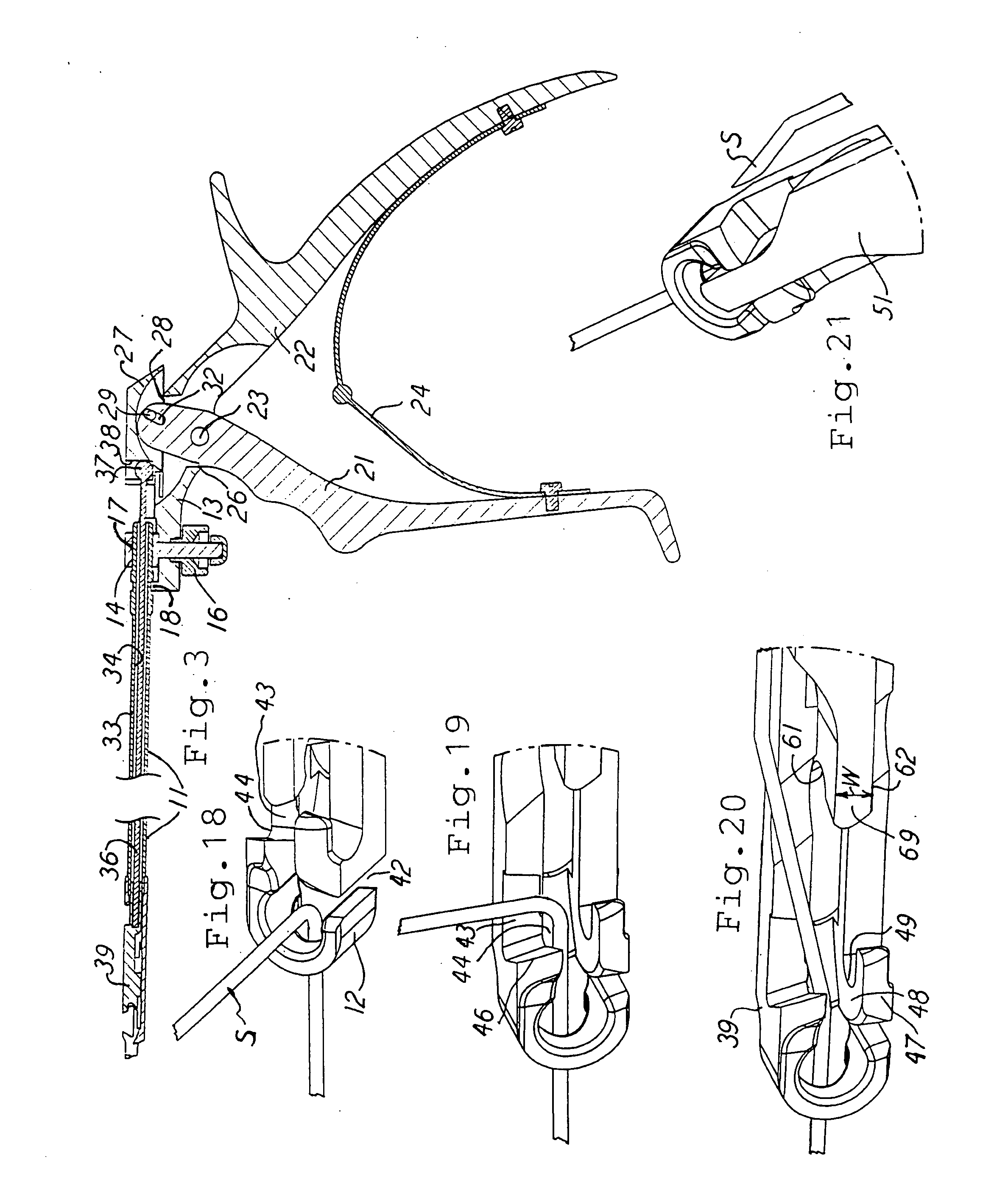 Surgical suture cutter