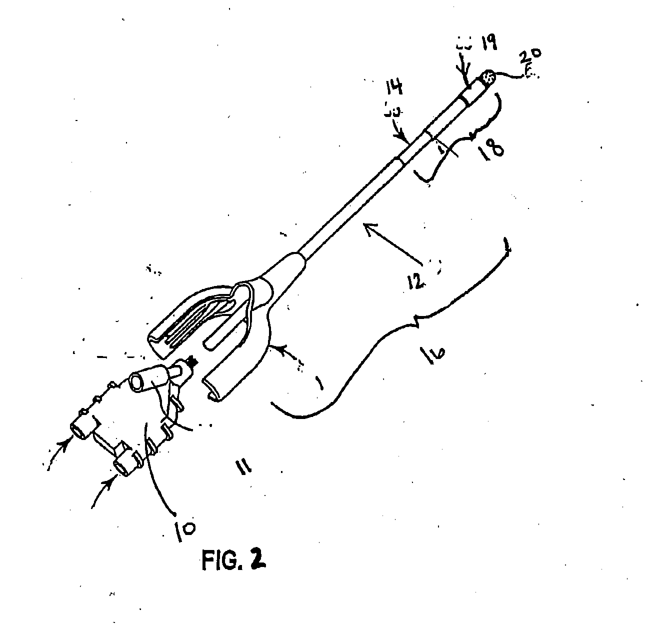 Multi-sectioned cannula with at least one lumen