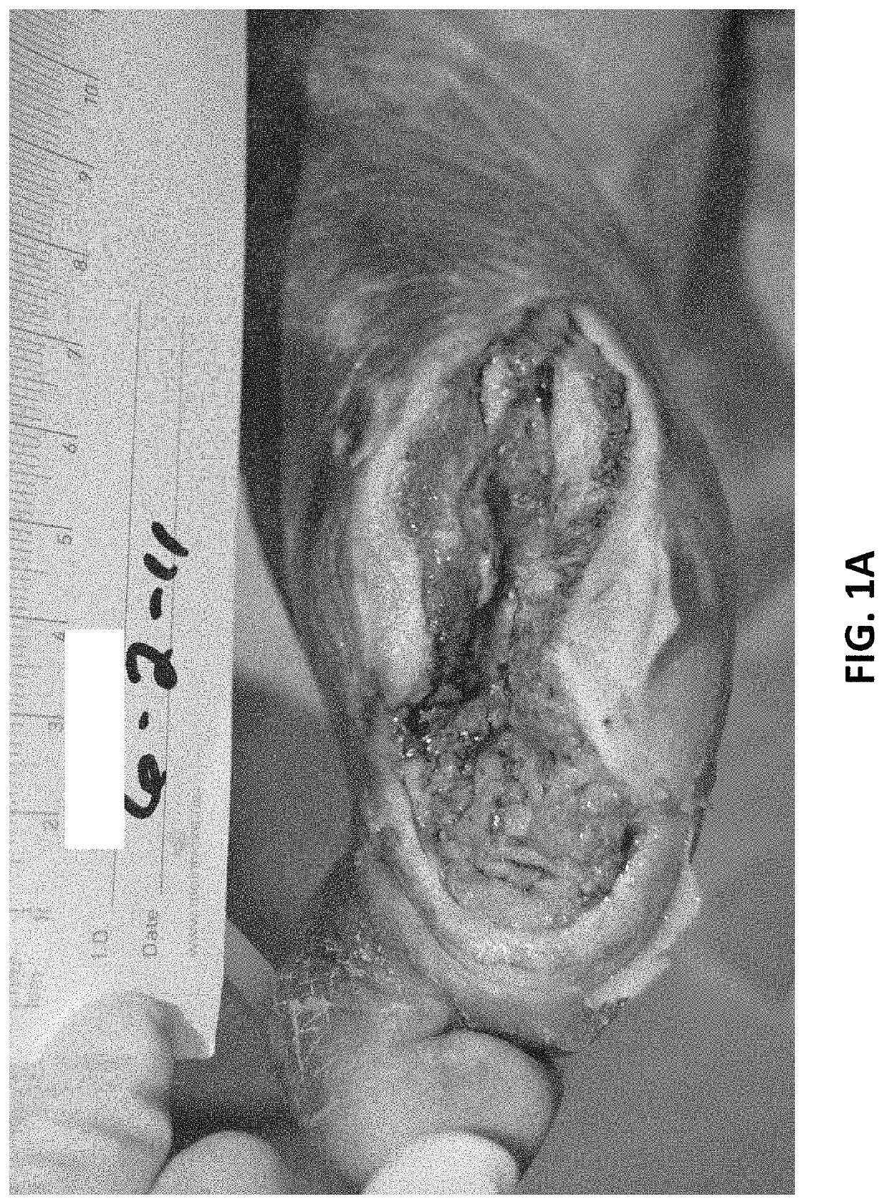 Formulations and methods for wound treatment