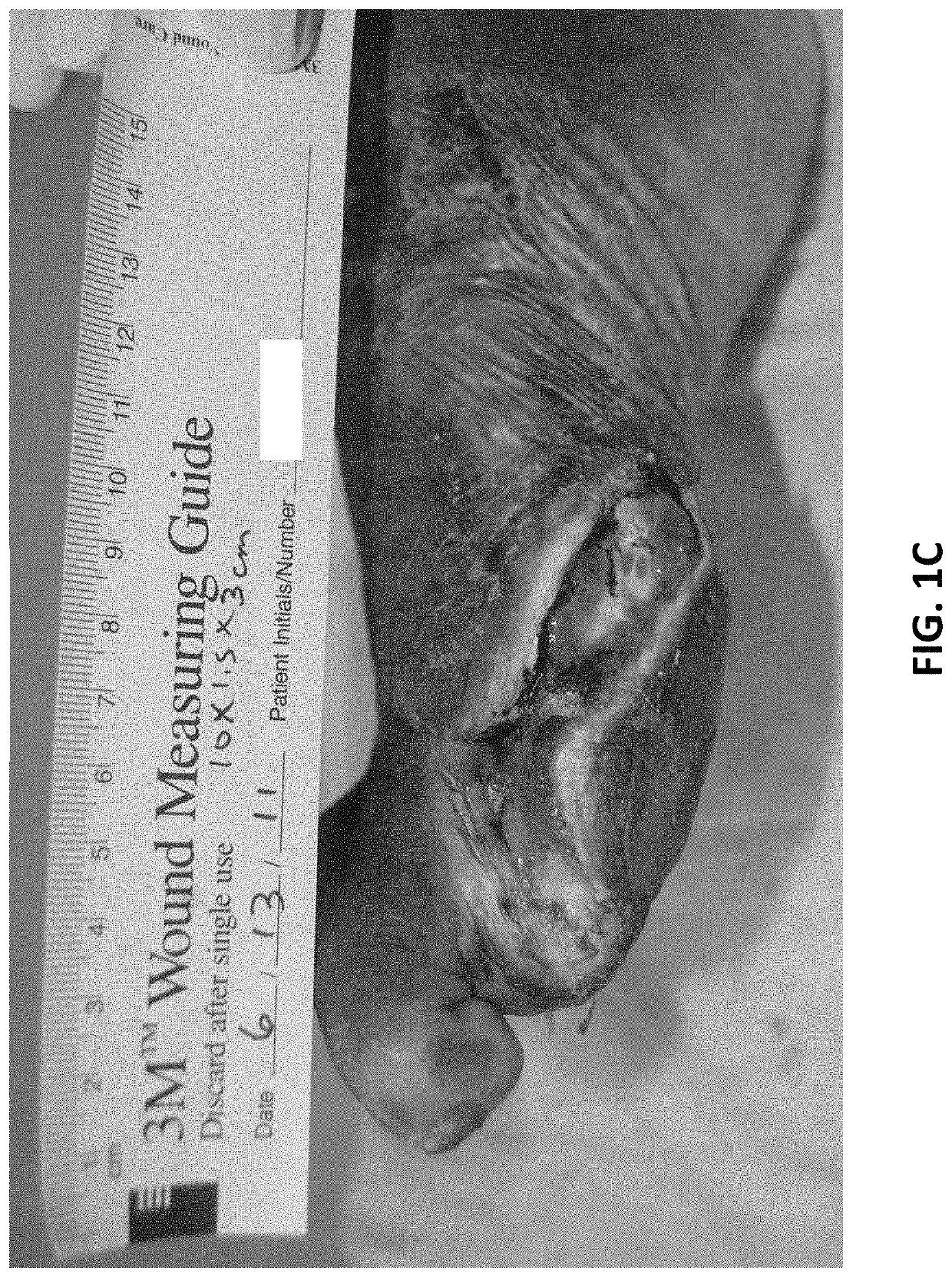 Formulations and methods for wound treatment