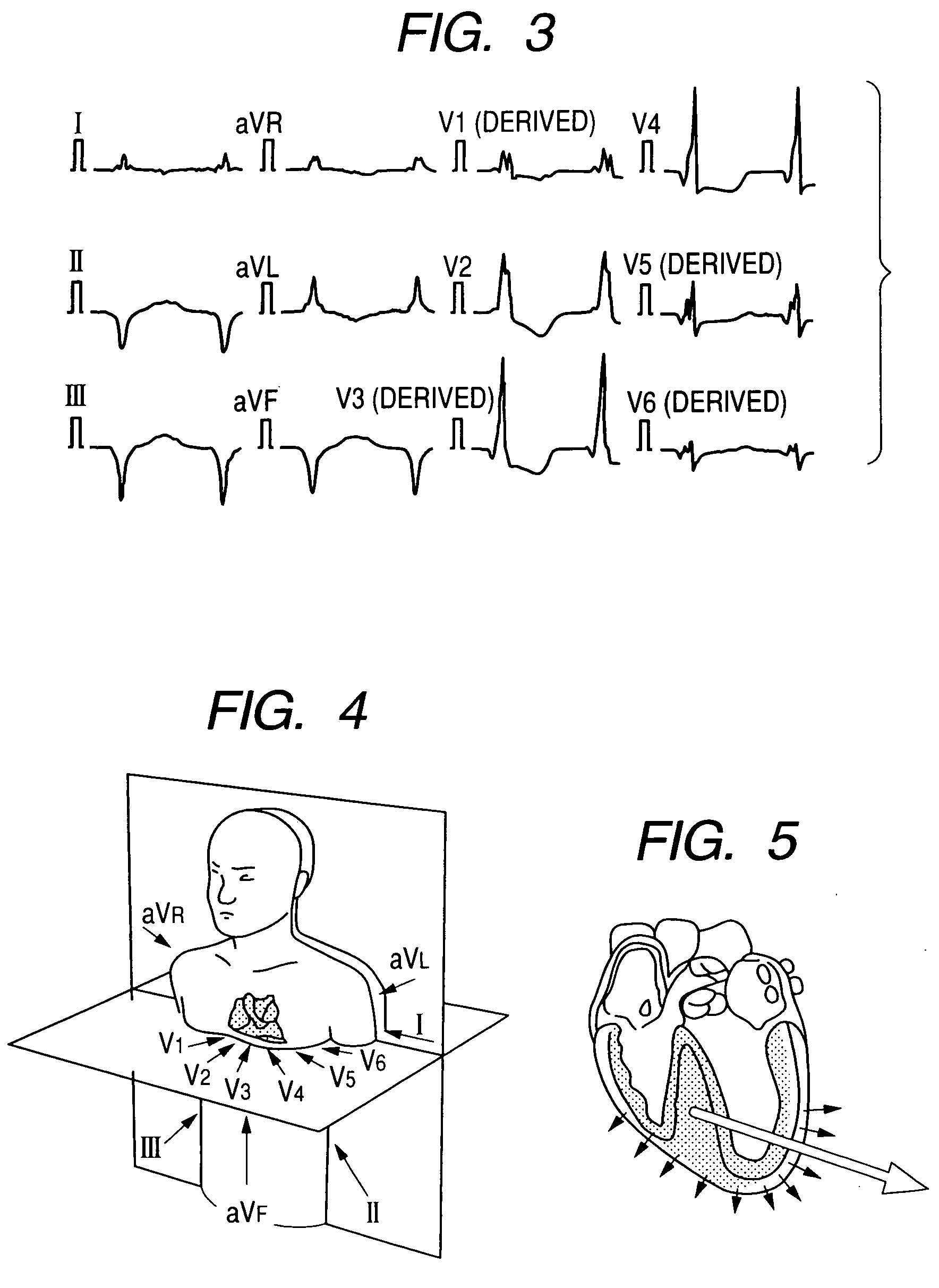 Method for deriving standard 12-lead electrocardiogram, and monitoring apparatus using the same