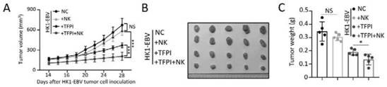 Application of combination of NK cells and TFPI in prevention and treatment of nasopharyngeal carcinoma