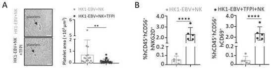 Application of combination of NK cells and TFPI in prevention and treatment of nasopharyngeal carcinoma