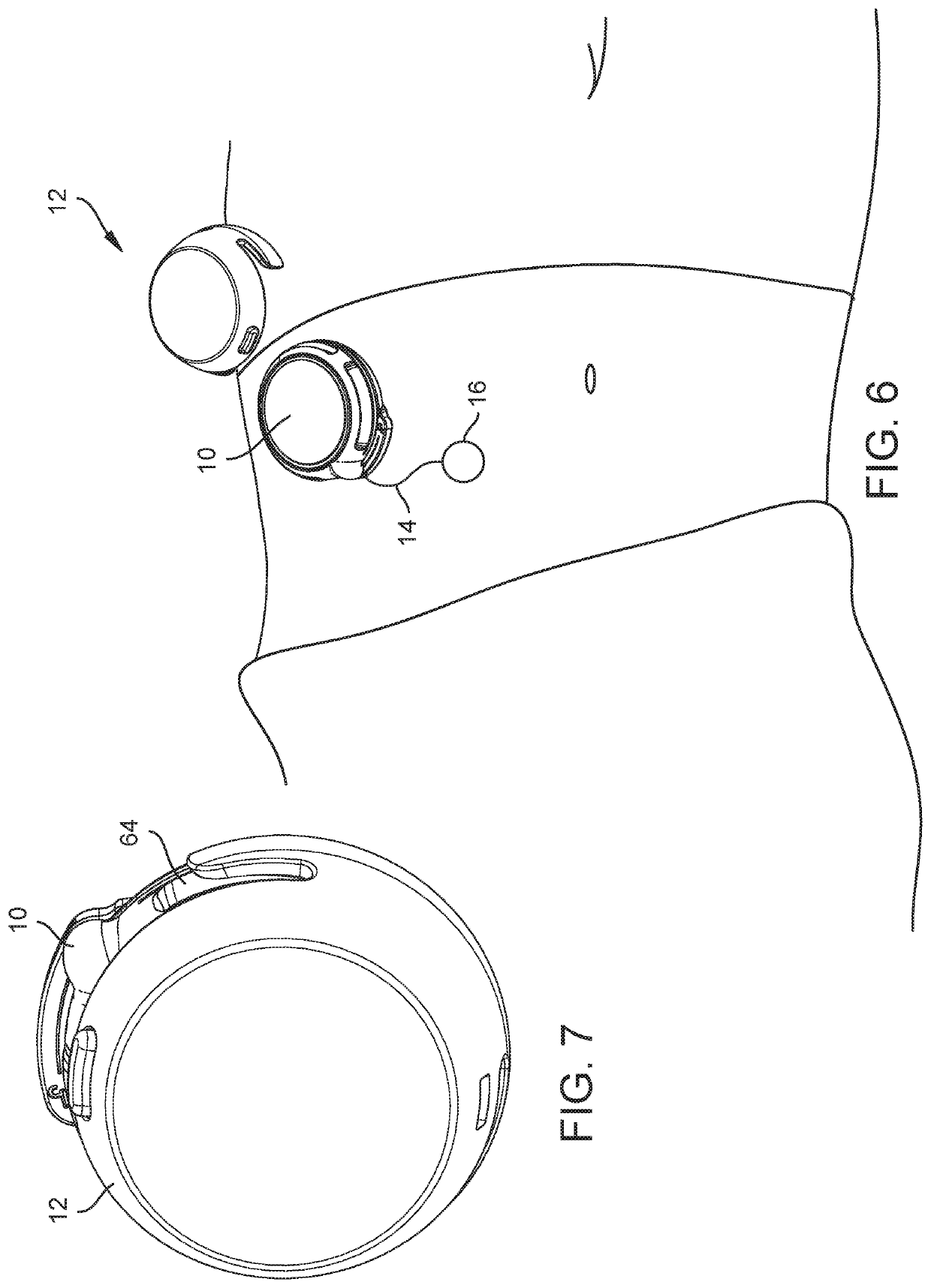 Medical Device, Method and Systems