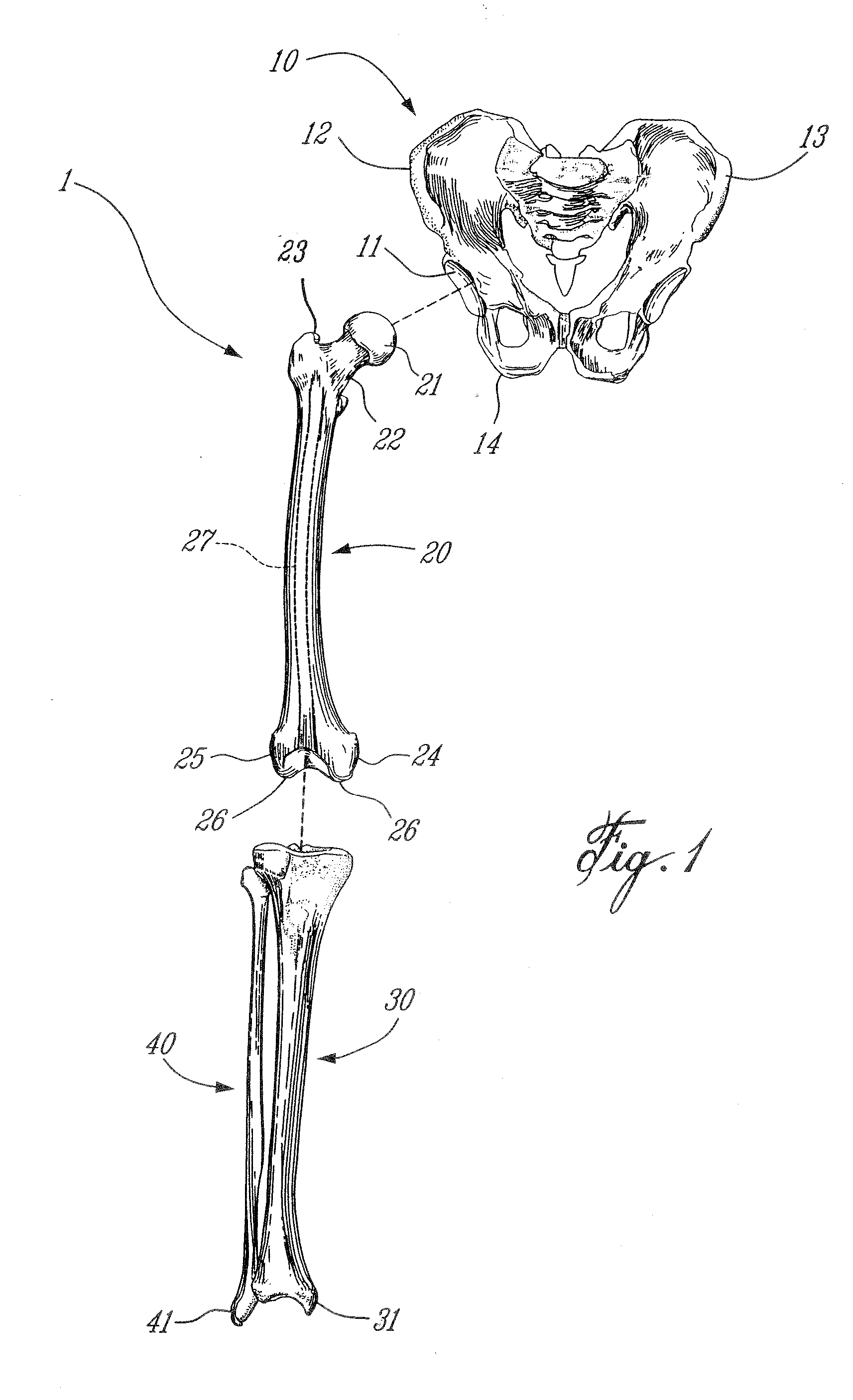 Computer-assisted surgery tools and system