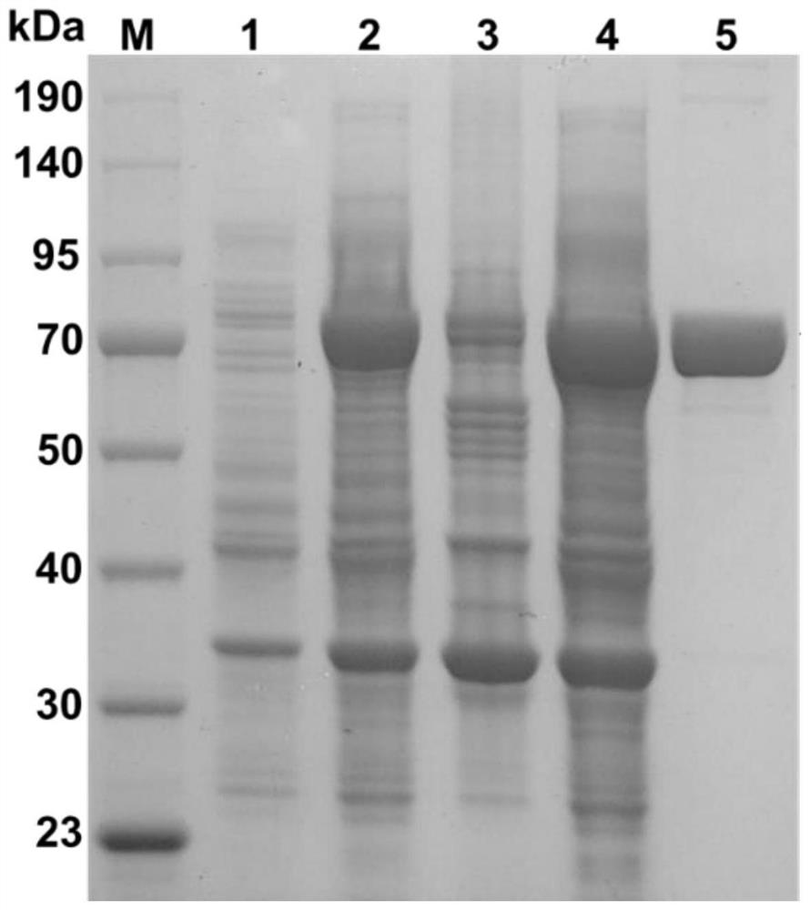 Recombinant chondroitinase AC and preparation method and application thereof