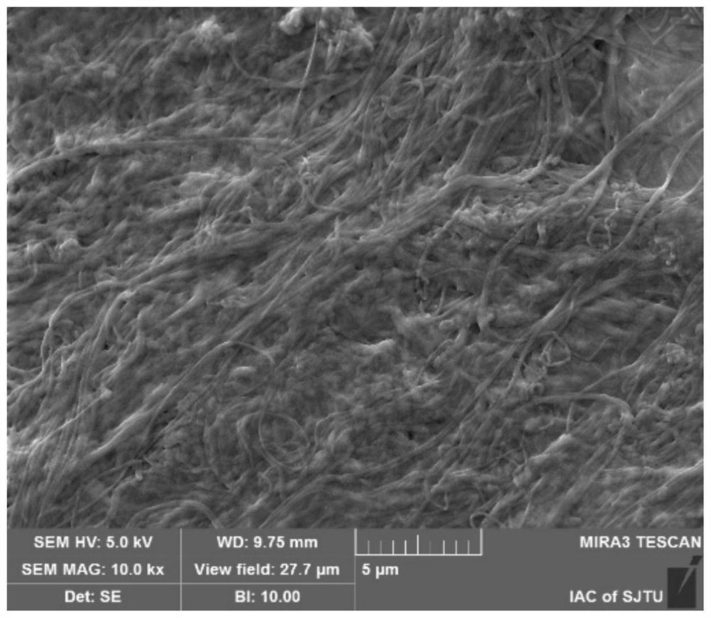 Acellular matrix particle product for soft tissue filling and repairing, and preparation method of acellular matrix particle product