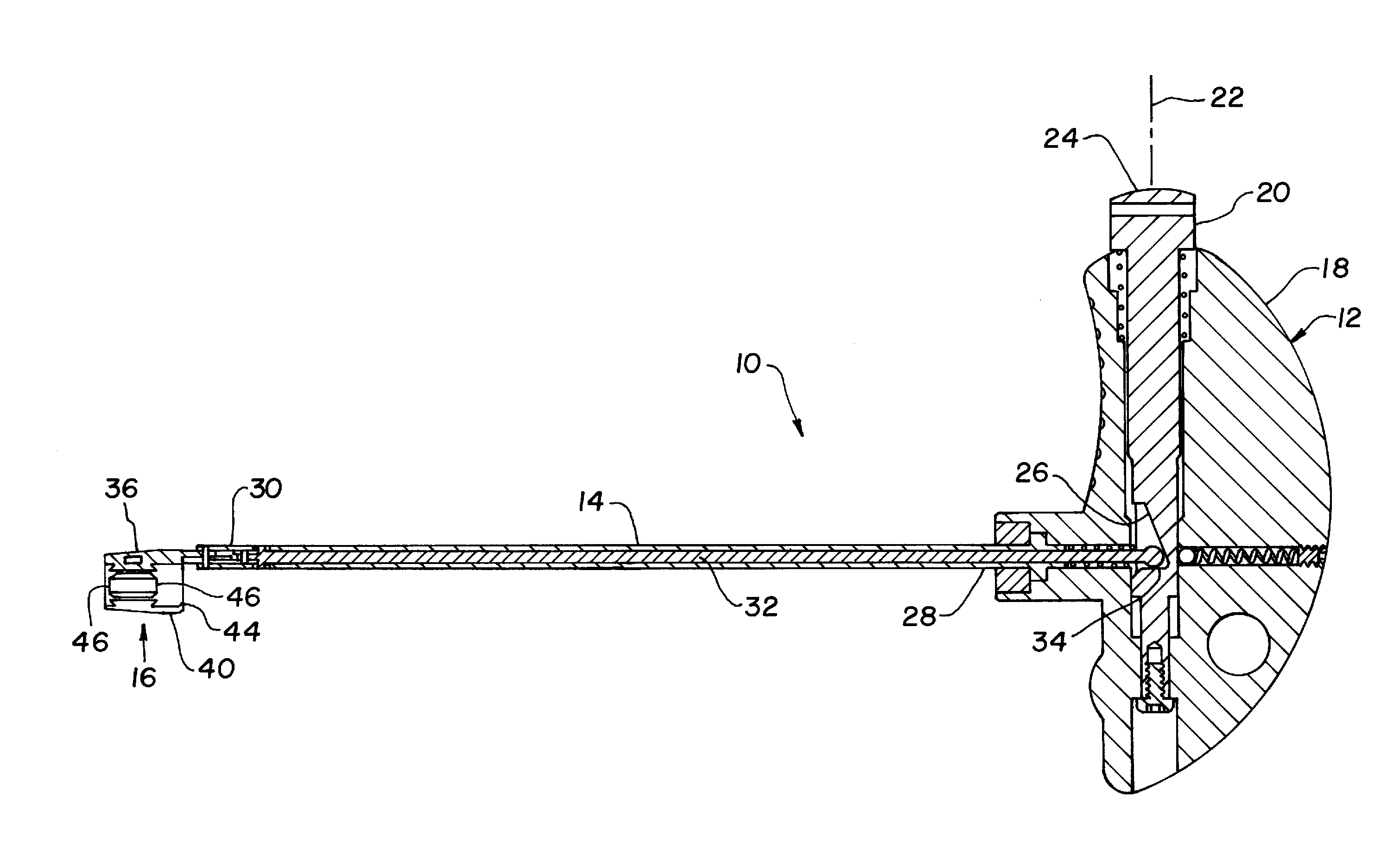 Cuffed-catheter remover