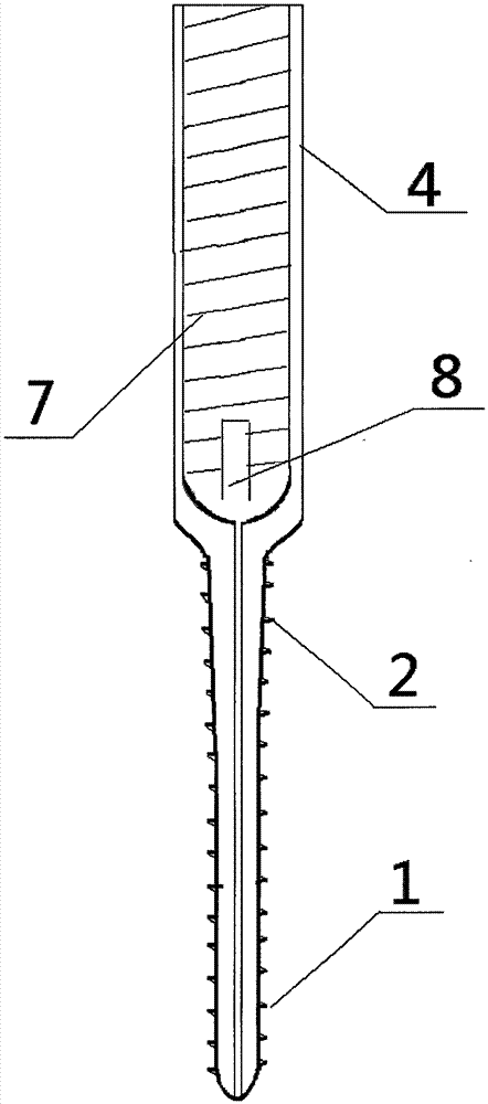 Vertebra pedical nail of thoracolumbar vertebral fracture posterior minimally-invasive screw-rod system