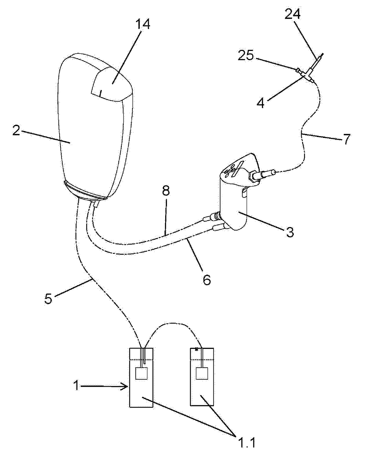 Injection equipment for endotherapy treatments in plants