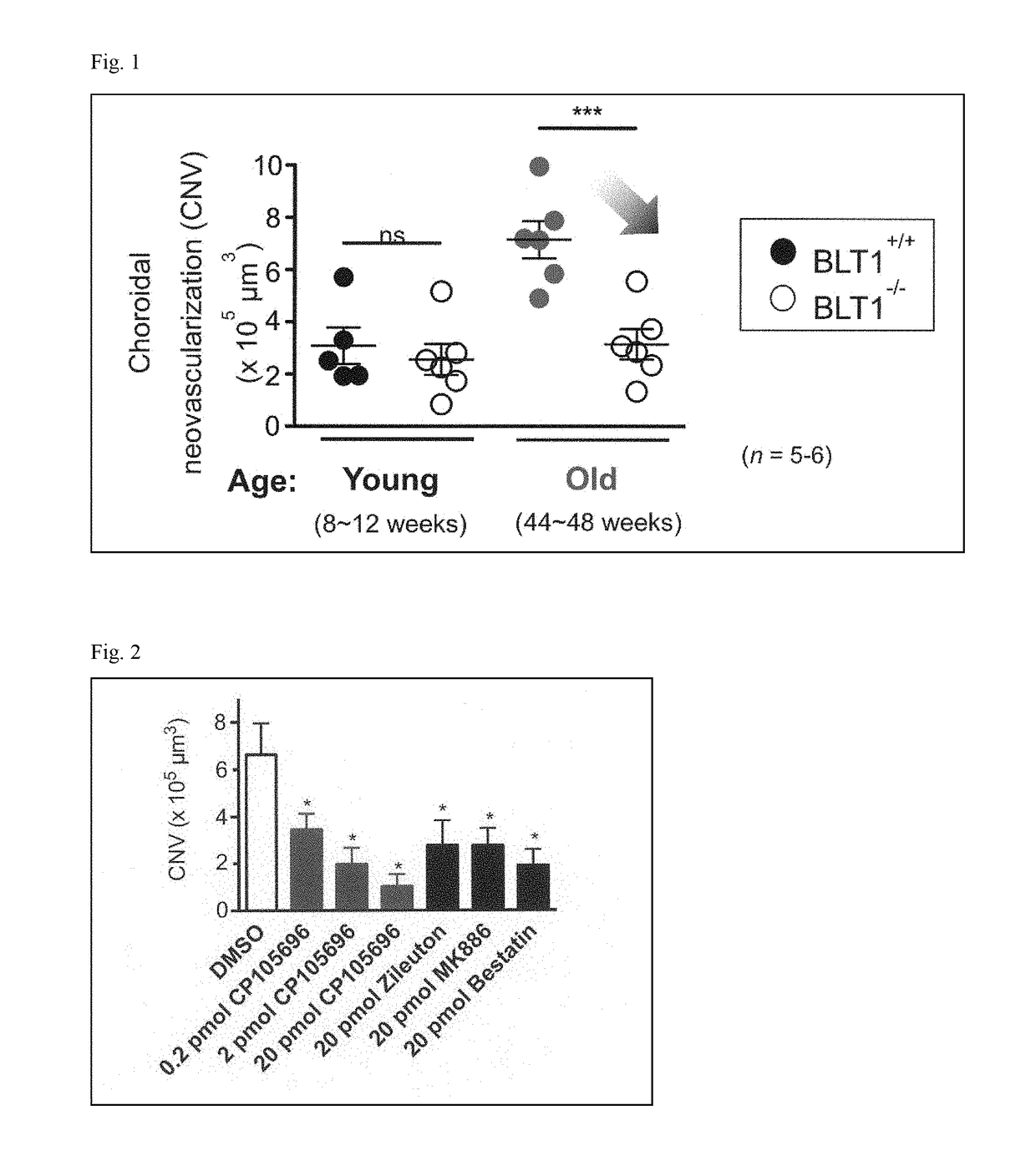 Preventive or therapeutic agent for age-related macular degeneration