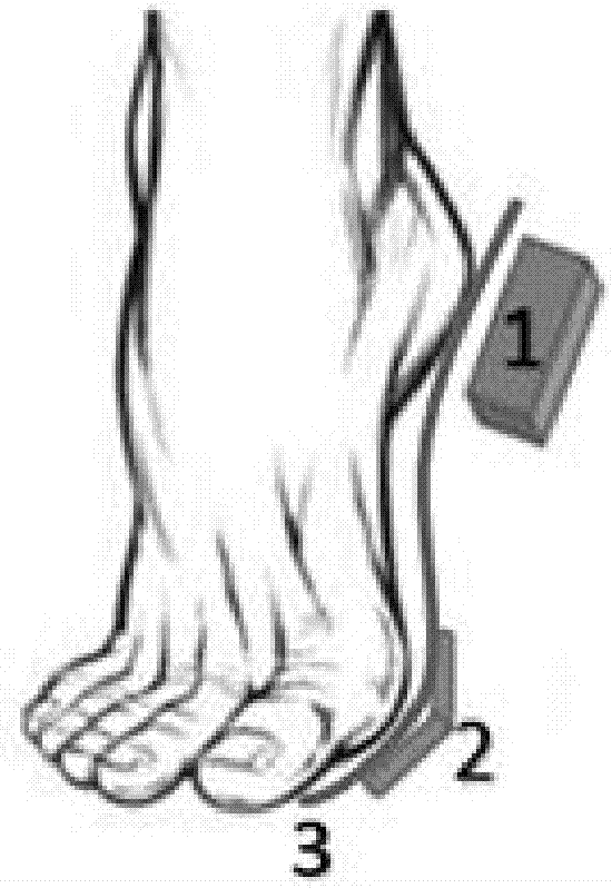 Foot posture recognition system