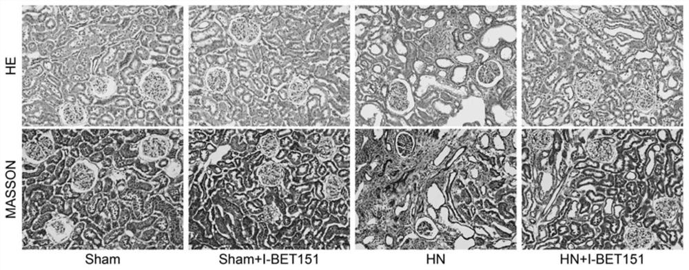 Drug for treating uric acid nephropathy