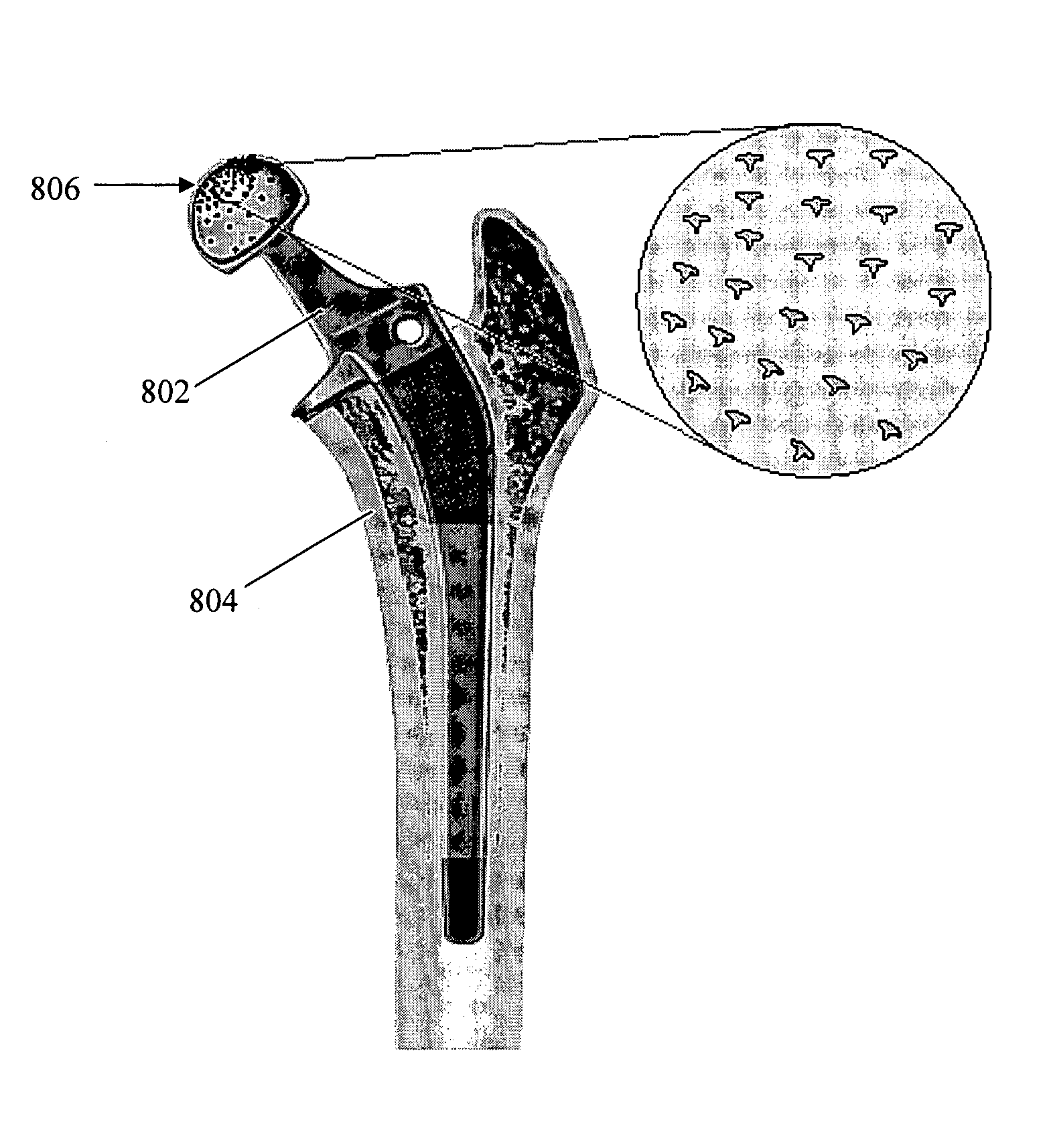 Textured surfaces for orthopedic implants