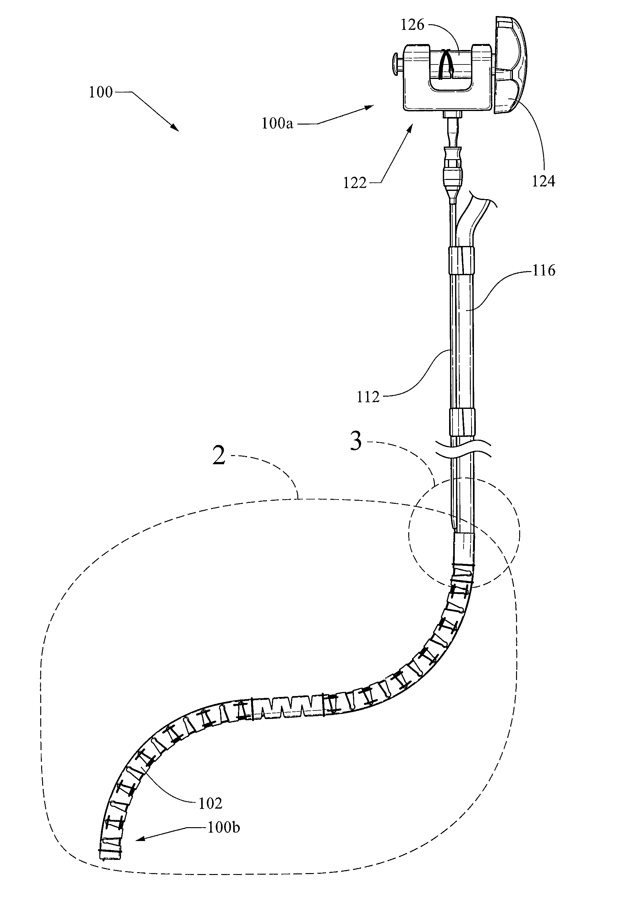 Endoscope stabilization system