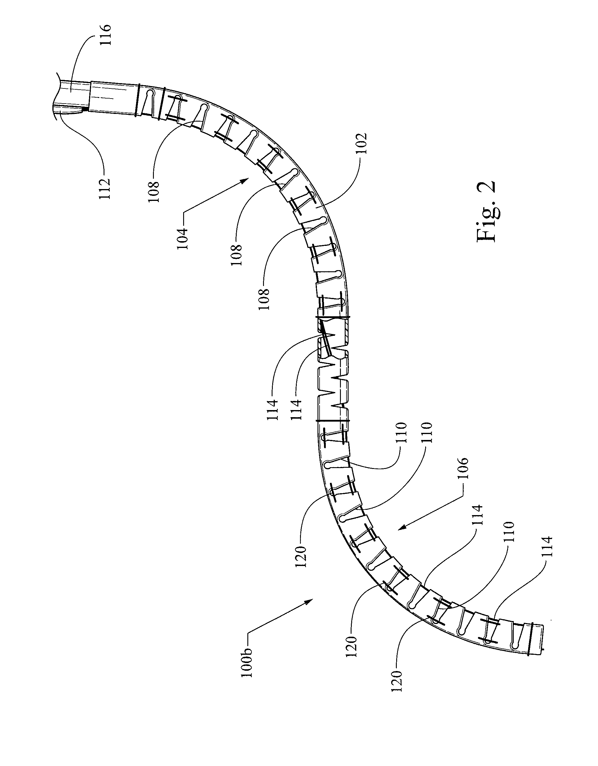 Endoscope stabilization system