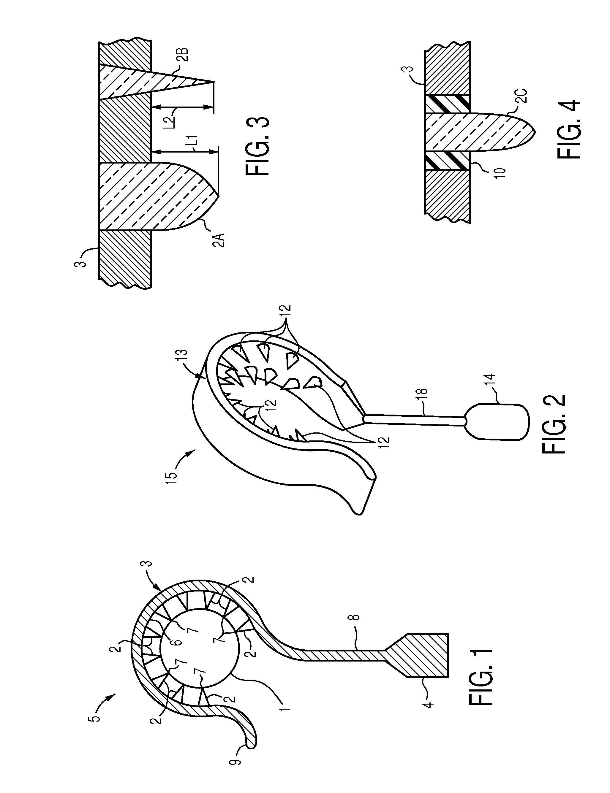 Middle ear prosthesis having discrete projections for purposes of ossicular attachment