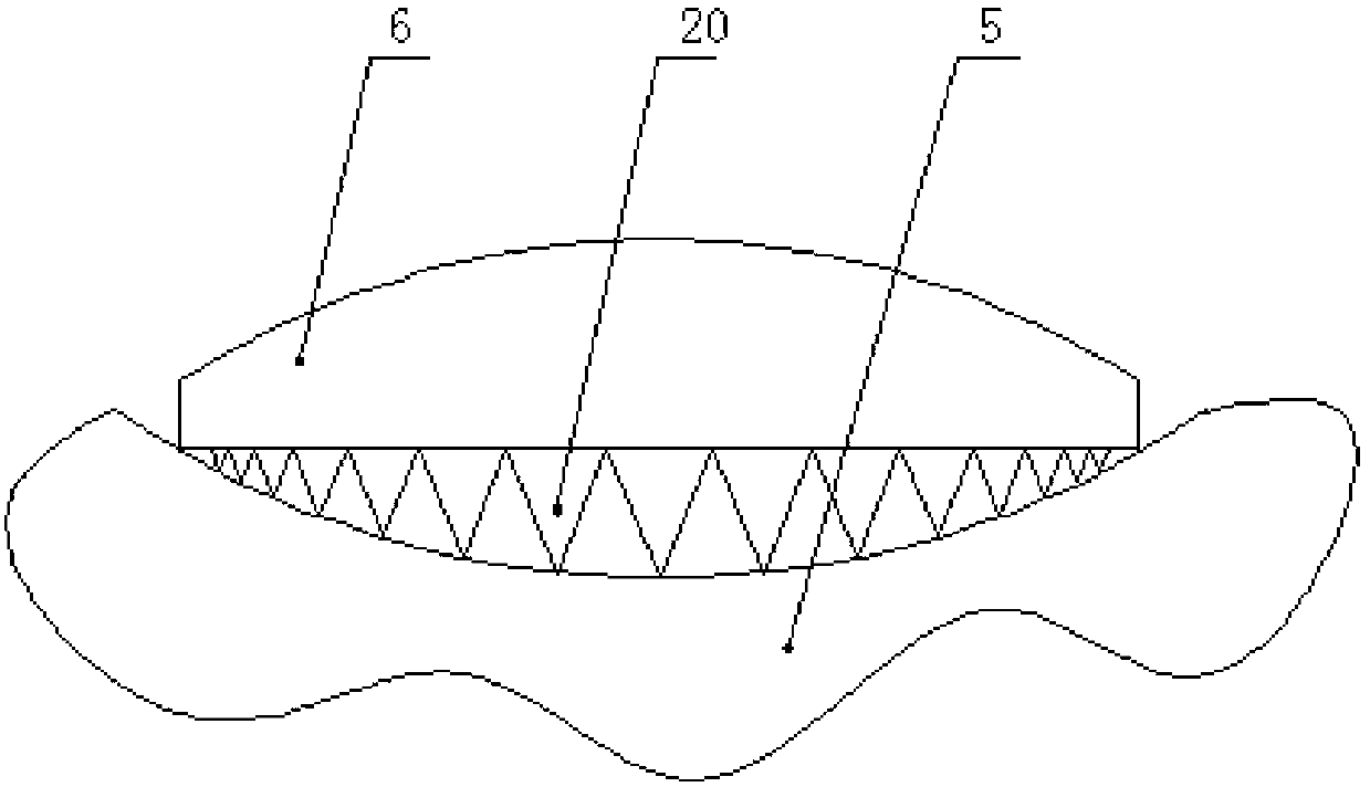 Slag removal device for outlet of molten iron runner of iron making blast furnace