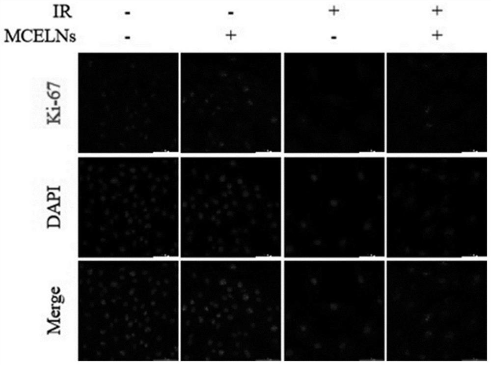 Application of bitter gourd exosome in radiation heart injury protection