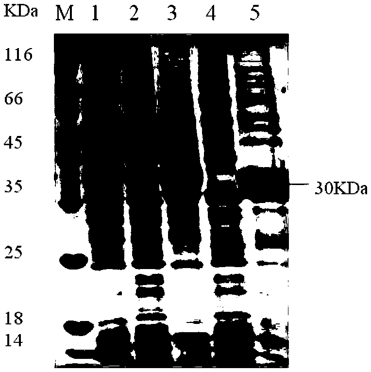 Construction method of mannheimia haemolytica LKTA protein prokaryotic expression vector and kit for detecting mannheimia haemolytica