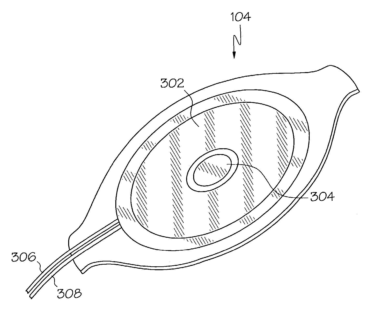 Electrocardiogram monitoring and cardiac therapy pulse delivery system and method