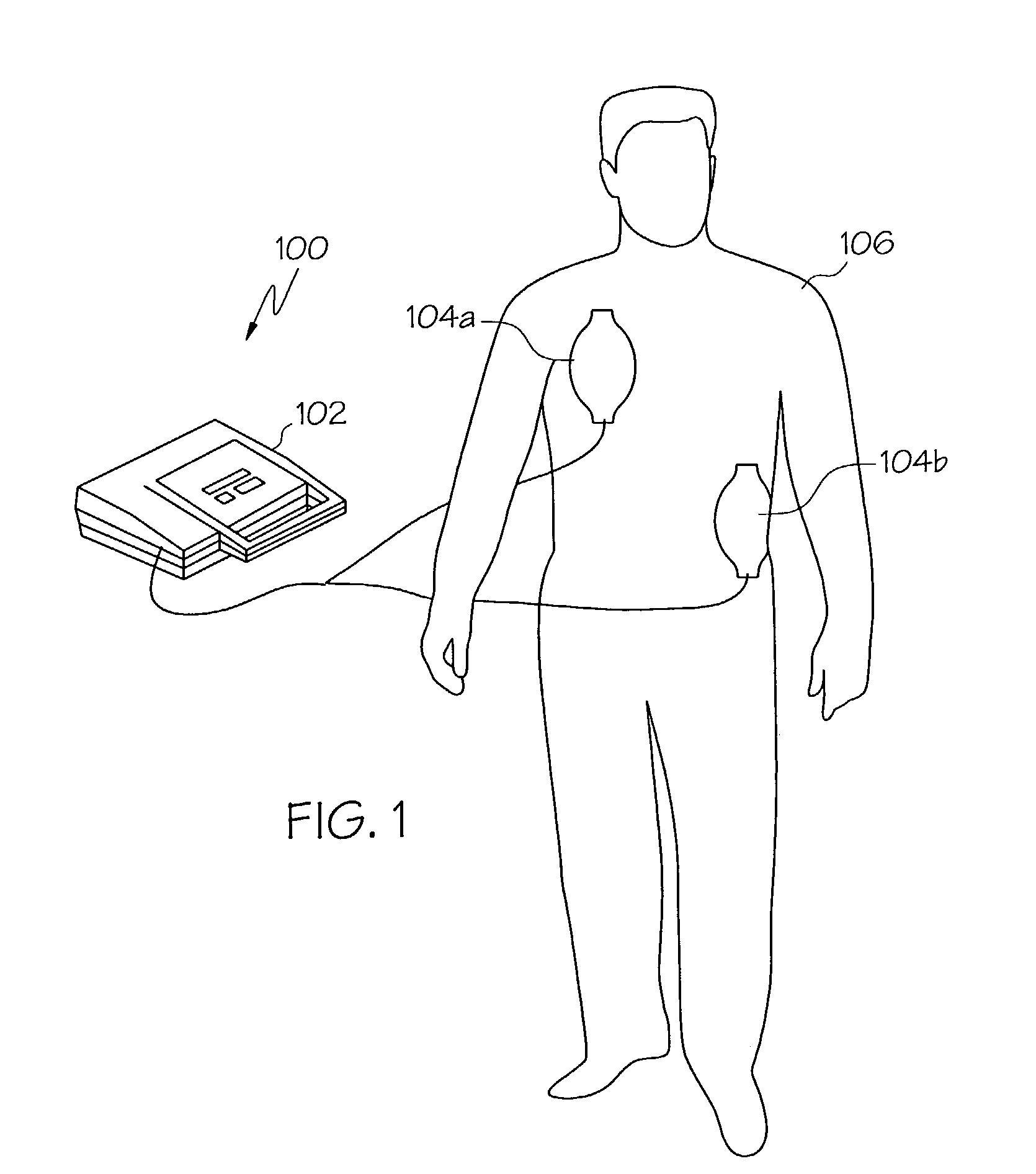 Electrocardiogram monitoring and cardiac therapy pulse delivery system and method